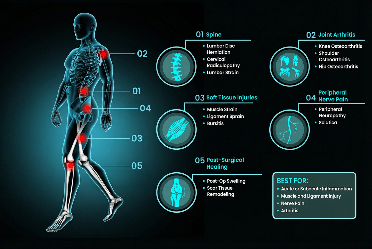 shockwave-therapy-graphic-02
