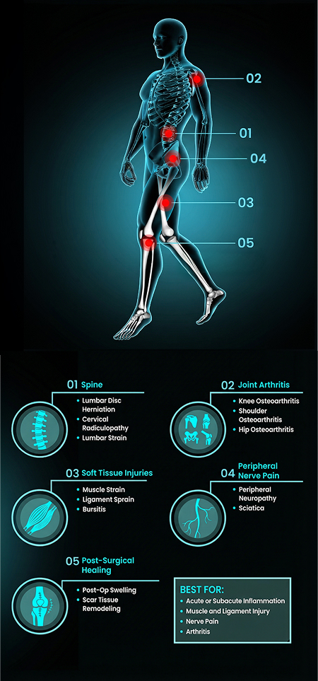 shockwave-therapy-graphic-02sm